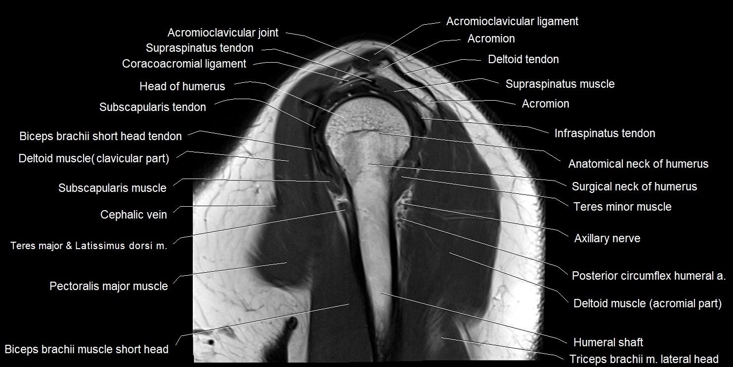 mri shoulder sagittal cross sectional anatomy image 11.webp